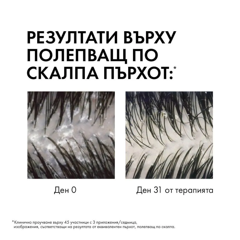 ВИШИ ДЕРКОС ШАМПОАН ПРОТИВ ПЪРХОТ ЗА СУХ СКАЛП 390 МЛ 3 Виши Деркос Шампоан против пърхот за сух скалп 390 мл